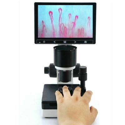 China Terminal Screen Microcirculation Microcirculation Microscope Nail Wall Observe Digital Microscope XW880 for sale