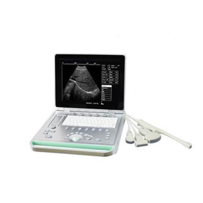 China UItrasound Instruments Laptop Computer Ultrasound Machine B/W Plastic Portable Ultrasound Scanner for sale