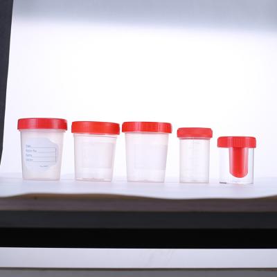 China Plastic Specimen Containers Sterile Disposable Plastic Urine Sample Container for sale