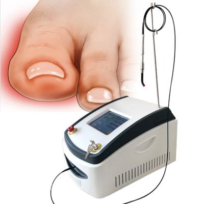 China 980nm nail fungus laser machine for toe nail fungus fungus nail treatment portable onychomycosi laser machine for sale