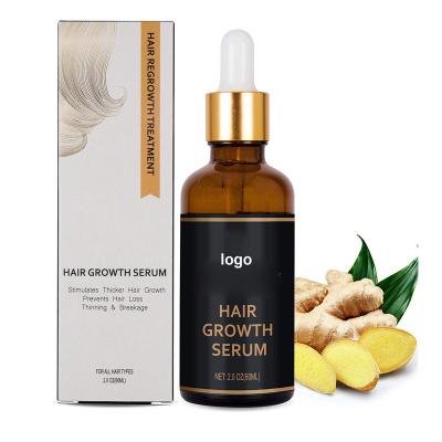 China Top Quality Natural Hair Loss Treatment Hair Growth Oil 100% Hair Growth Serum Drops for sale