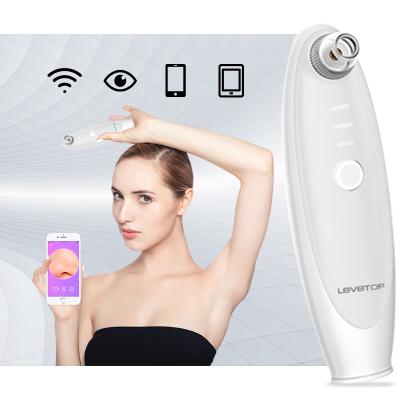 China Acne Treatment Remove Blackheads From Nose Suction Blackhead Remover High Vacuum for sale