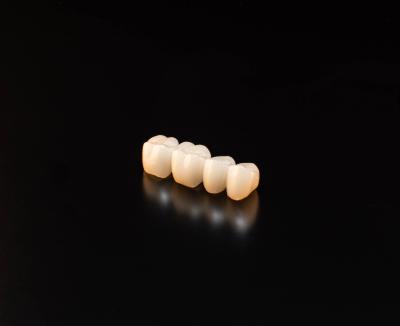 China LDL natural de contorno completo corona de zirconia en venta