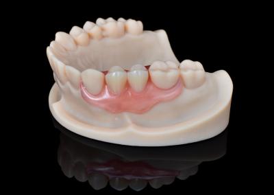 China Comfortable Flexible Dental Partials Durable Flexible Hypoallergenic Dentures for sale