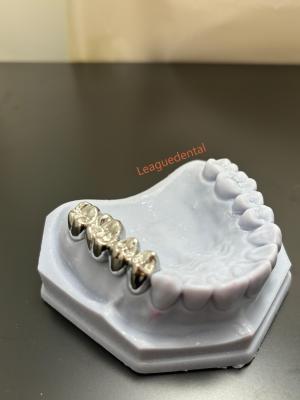 China Non Toxic Full Metal Crown Dental Full Cast Metal Crown Precise Customizable for sale