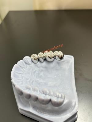 China Customized Alloy Full Cast Metal Crown Durable Dental Crown Full Metal for sale