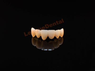 China Dental de contorno completo natural con corona de zirconia de alta resistencia en venta