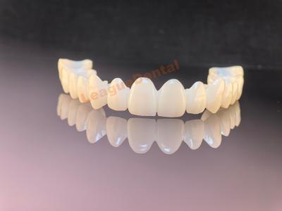 China Medical Grade Zirconia Dental Bridge Durable And Aesthetic Zirconia Bridges for sale