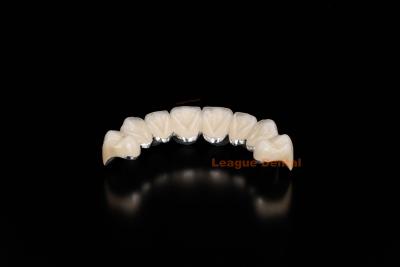 China Co Cr Ceramic PFM Restorations Cad Cam PFM Crown Natural Looking for sale