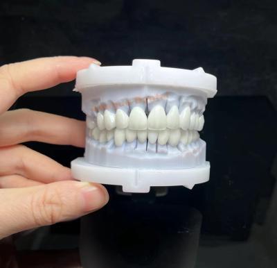 China Natural Porcelain Fused To Zirconia Translucent PFZ Bridge And Crown for sale