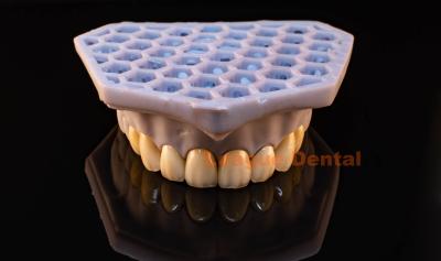 China Melhorias Dentárias PFZ Coroas CAD/CAM 0.3mm E.MAX Veneer Natural à venda