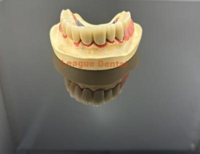 China Corona de resina compuesta híbrida Escaneo digital Impresión 3D Corona dental en venta