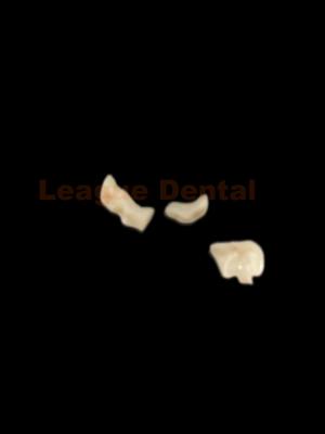 China Enlaces dentales naturales de zirconia de alta resistencia Enlaces dentales naturales para dientes posteriores en venta