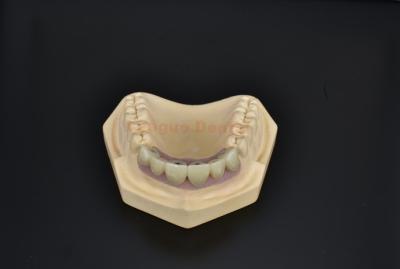 China Zirconia Cement Retained Implant Crown Restorative Dental Implant Crown Replacement for sale