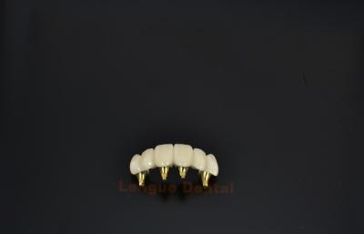 China Precision Flexibility Multi Unit Abutment Implant For Complex Implant Restorations for sale