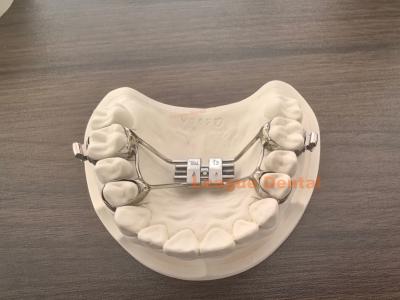 China Adjustable 3 Way Palatal Expander High Strength Removable Palate Expander for sale