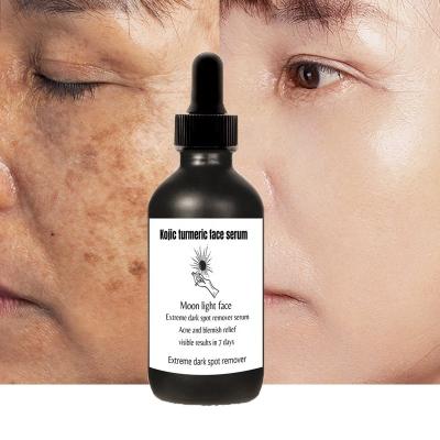 China Effective Anti Wrinkle Private Label Turmeric Dark Spot Remover Kojic Face Serum For Dark Spots Fade Away for sale