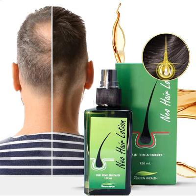 China Original Neo Hair Loss Prevention Lotion 120ml Green High Quality 100% Wealth Care Spray To Stop Hair Loss Root Nutrients for sale