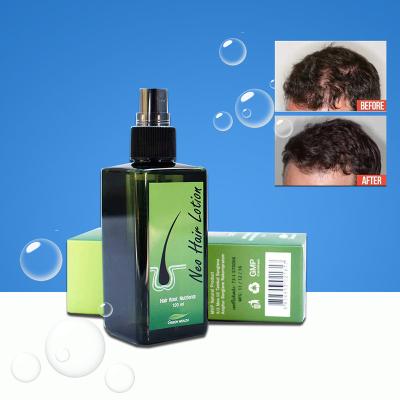 China High Quality Neo Loss Prevention Hair Lotion Scalp Treatment Hair Loss Root 100% For Woman Man Hair Lotion for sale