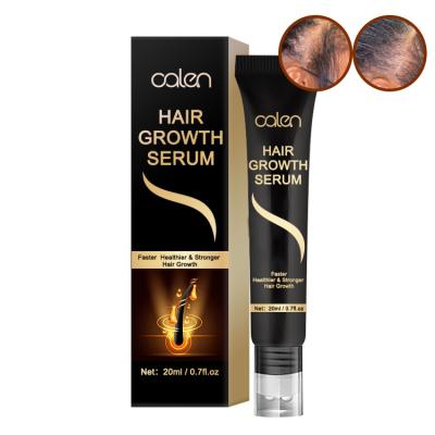 China OEM ODM Hair Growth Products Rapid Hair Growth Regenerating Serum For Black Women Private Label for sale