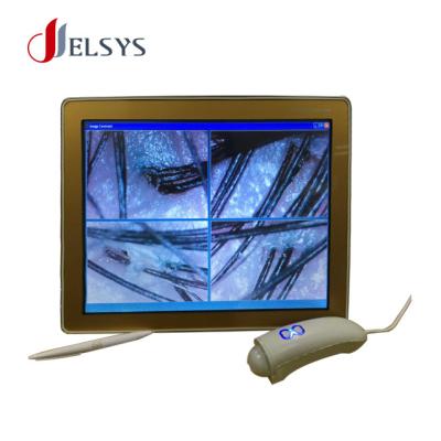 China New from Jelsys Skin Wrinkle Analysis Makes Beauty Salon Use Skin and Hair Analyzer Hair Analysis Device for sale