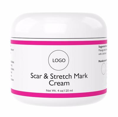 China Best Private Label Brightening Natural Scar And Stretch Mark Removal Cream for sale