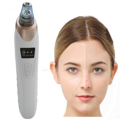 China Hot Selling Portable Facial Blackhead Remover Acne Treatment Acne Treatment Multifunctional Electric Vacuum Pore Pore Extractor for sale