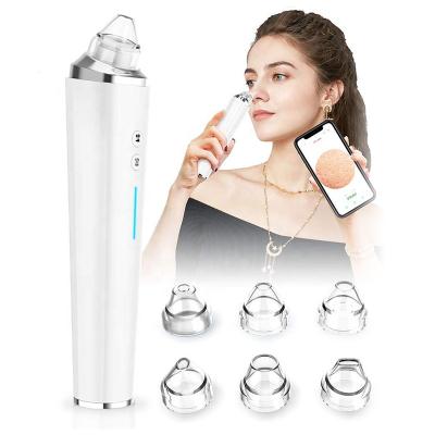 China Acne Treatment WiFi 20X Microscope Pimple Pimple Sucker Visual Suction Removal Blackhead Vacuum Facial Remover With Camera for sale