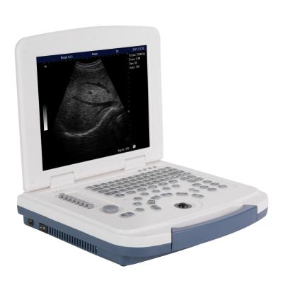 China Ultrasonic Plastic Medical Equipment Imagine Black And White Full Diagnosis Digital Ultrasound for sale