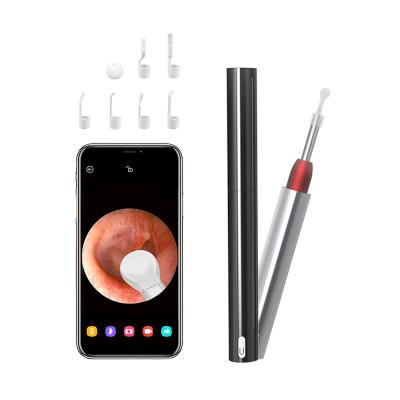 China Ear Otoscope Friends Ear Otoscope Camera HD Ear Cleaner Visual Ear Cleaning Scope for sale