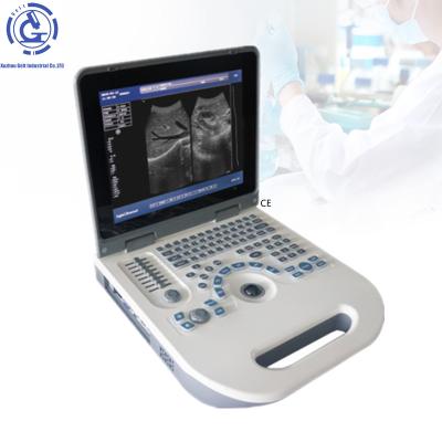 China Portable OB Ultrasound Machine USG Scanner In Medical Instrument Te koop