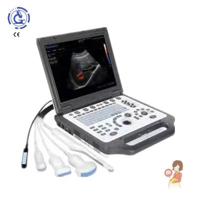 China OB Dipole Array Probe Digital Full Ultrasound With Microconvex Probe PW CW Color Doppler Ultrasound for sale