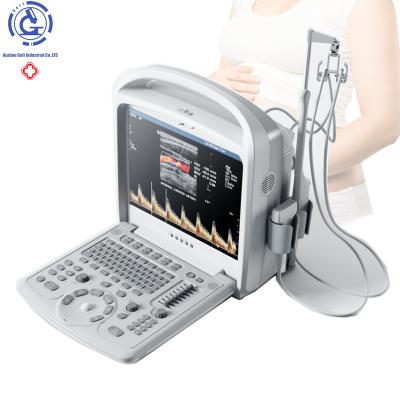 China Portable Cardiac Vascular OB Color Doppler Ultrasound 15