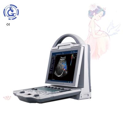 China Cardiac OB Ultrasound Machine with Doppler Function and Four Probes for sale