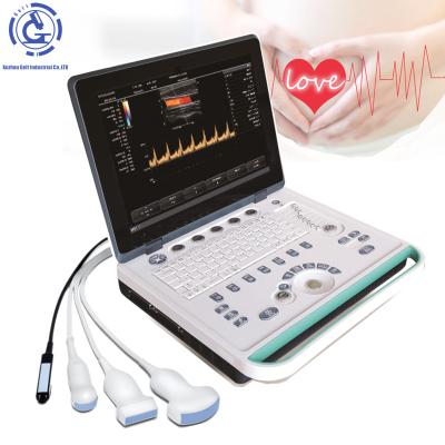 China Portable OB Ultrasound Machines Sonoscape S9 Doppler Ultrasound Scanner for sale