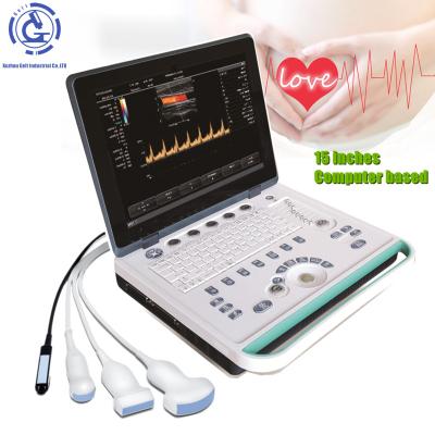 China Cheapest discount price laptop 3D OB GYN portatil ultrasonido digital ecografo OB portable ultrasound machine for sale