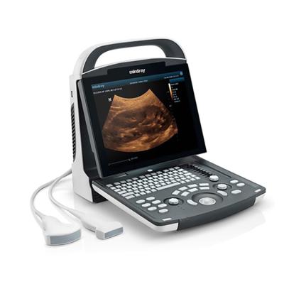 China Clinic Ultrasound Scanner Portable Ultrasound Machine Conversion Notebook High Frequency Ultrasound Scanner for sale