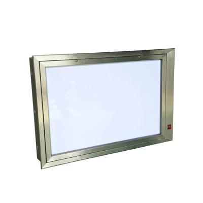 China Hospital Odm Operating Room X-Ray Film Viewer X-Ray Film Viewer Led Dual Viewing Box for sale