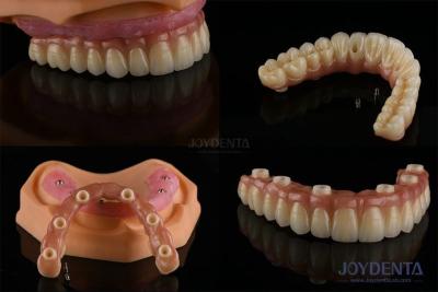 China Dentistas Dentes múltiplos Implantes de superfície rugosa Componentes protésicos à venda