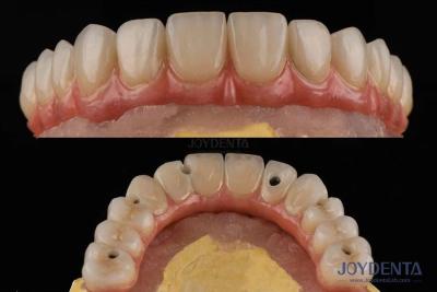 Cina Piattaforma di impianto dentale di superficie ruvida ponti dentali con connessione interna in vendita