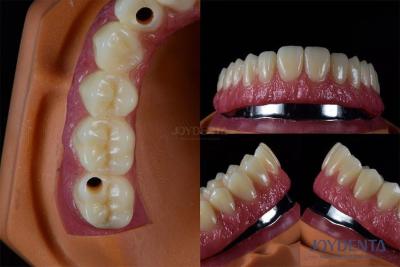 China Titanium Multiple Dental Implants Teeth Internal Implants Cracking Resistant Customized for sale