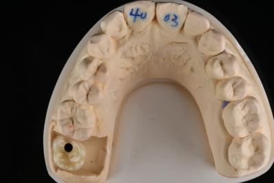 China Material de imitación híbrida de zirconia dental de grado profesional Superficie lisa o áspera en venta