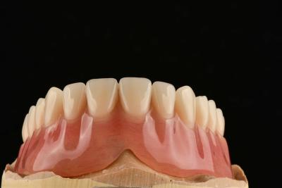 China Comfortable Clear Adjustable Removable Partial Denture That Resemble Natural Teeth for sale