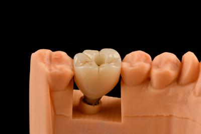 China Implantes dentales de titanio de 10 mm con empuje de arena en venta