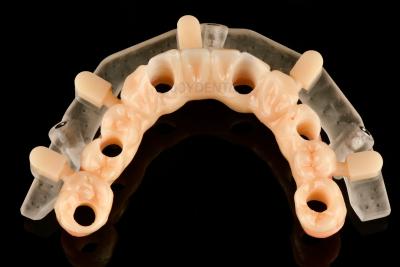 China Custom Precision 3D Printed Guided Surgery Templates For Accurate Implant Placement for sale