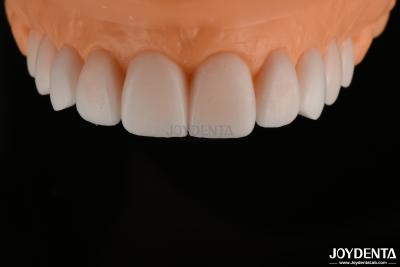 China Smooth Replicated Diagnostic Wax Up FDA , Full Arch Teeth Wax Up Highly Accurate for sale