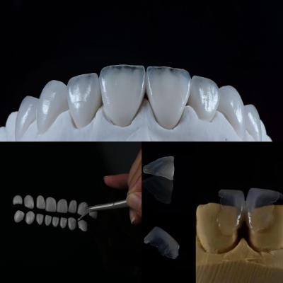 Cina Finitura in vetro ceramica: con questa soluzione dentale di prim'ordine si ottiene un sorriso naturale in vendita