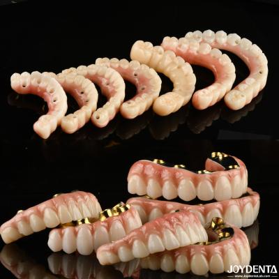 China Implant Crown and Bridge The Trusted and Proven Choice for Dental Reconstruction for sale