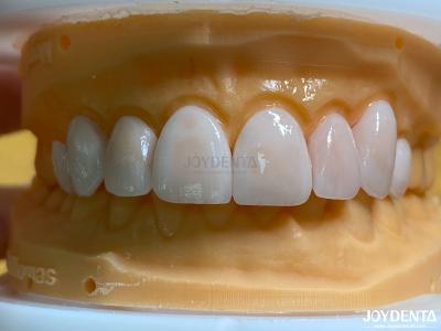 China Hoogpermeabiliteit Natuurlijke veneers Porselein veneers Emax Op maat Te koop