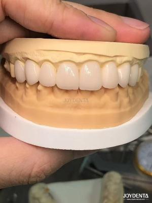 China 16 schakeringen Kleur Emax Tandheelkundige veneers A1-A4 Hoge vlekbestendigheid voor een perfecte glimlach Te koop